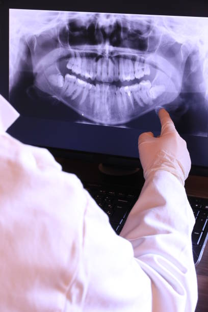 Best Root Canal Emergency Dentist  in Chester, CA